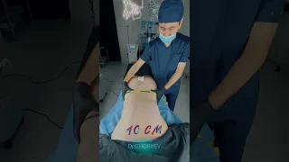 Операция и Консультация +998-90-122-77-76 #plasticsurgeon #drchoriyev