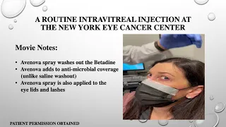 Eye Cancer Specialist: New Intravitreal Injection Methods