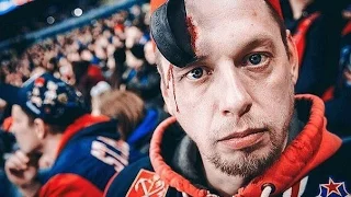 Хоккеист НХЛ шайбой разбил лицо болельщику