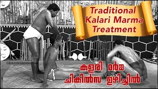 Traditional Kalari Marma Treatment