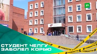 Студент ЧелГУ заболел корью. В вузе ввели ограничения