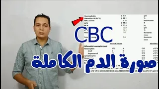 CBC ازاى تقرا تحليل صورة الدم الكاملة