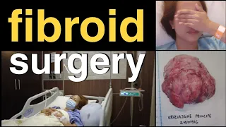 FIBROID SURGERY - ABDOMINAL MYOMECTOMY | PRE , POST OP & RECOVERY : BEHIND THE SCENES VLOG | Part 1