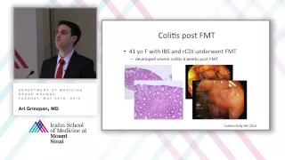 Fecal Microbiota Transplantation