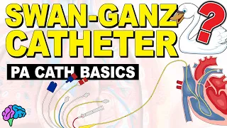 The BASICS of the Pulmonary Artery Catheter