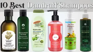 10 Best Dandruff Shampoos In Sri Lanka With Price 2022 | Chemical Free Shampoo | Glamler