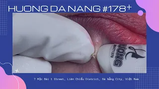 #178 | Huong Da Nang