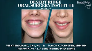 Lip Lengthening Procedure By Dr Broumand