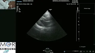 basic adult echocardiography live workshop 1