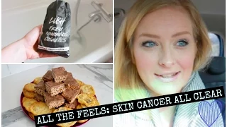 VLOG | ALL THE FEELS: SKIN CANCER ALL CLEAR