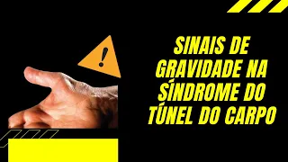 Sinais de gravidade na Síndrome do Túnel do Carpo