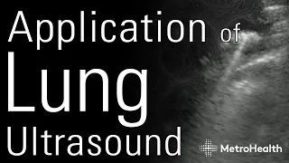 Application of Lung Ultrasound