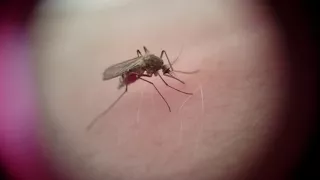 Комар сосет кровь ЖЕСТЬ!!! макросъемка