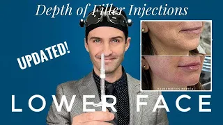 Injectors Anatomy (Updated!): Depth of Dermal Fillers - Lower Face