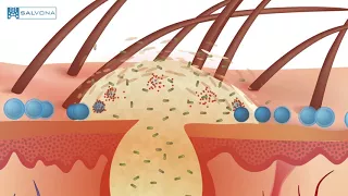 Animation: SalSphere® Even Skin / SalSphere® Salicylic Acid