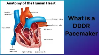 What is a DDDR Pacemaker