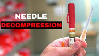 How To: Chest Needle Decompression