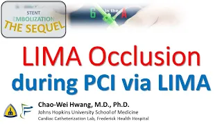 LIMA Occlusion during LAD PCI via LIMA