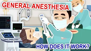 General Anesthesia #:1 How does it work?