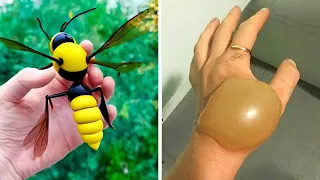 20 Most Painful Insect Bites In The World