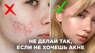 5 ошибок в уходе за кожей, из-за которых появляются прыщи