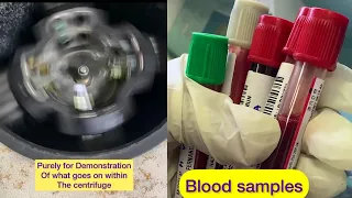 How to use a centrifuge?- Equipment used in laboratory