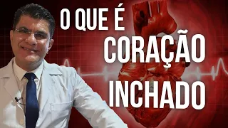 INSUFICIÊNCIA CARDÍACA, o que é? como prevenir? O Famoso Coração Inchado - Dr. Manoel Paz Landim