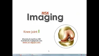 Imaging of the Knee joint (I) (DRE) Prof. Mamdouh Mahfouz