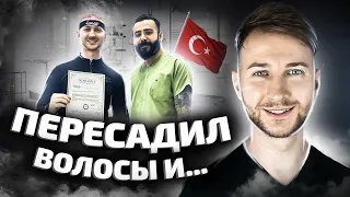 ВСЯ ПРАВДА ПРО ПЕРЕСАДКУ ВОЛОС❗️ВЕСЬ ПРОЦЕСС ПЕРЕСАДКИ ИЗНУТРИ⛔️