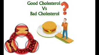 LDL and HDL Cholesterol: "Bad" and "Good" Cholesterol