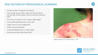 Latest thinking in scar prevention and treatment   A guide to managing and treating scars