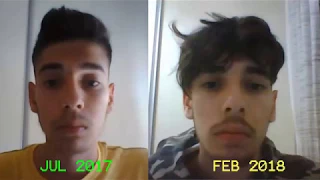 Top hair growth time lapse  - 7 months