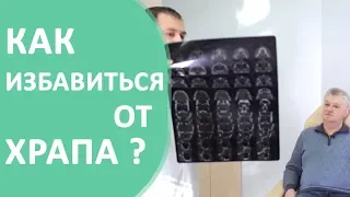 Операция от храпа в Москве 😪 Рекомендации к проведению операции от храпа. ЛОР-врач Александр Горовой