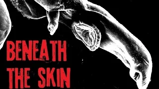 "Beneath The Skin" (Creepypasta by Tim Sonski)