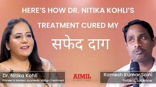 How Dr. Nitika Kohli Helped Me Cure White Patches | A Patient's Testimonial For Vitiligo Treatment