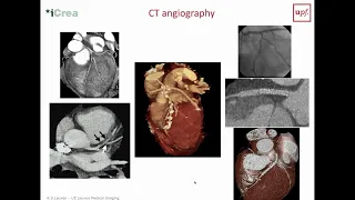 Medical Imaging Modalities -  Cardiac Imaging 2/3