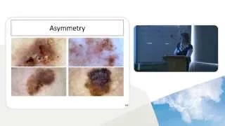 PHARMAC Seminar Series: Dermoscopy, 4b of 5. Chaos and clues: selecting lesions to excise - part 2