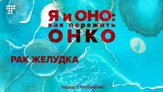 Рак желудка: диагностика, лечение, группы риска и профилактика