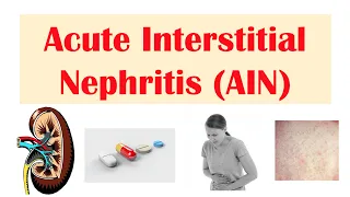 Acute Interstitial Nephritis (AIN) | Causes, Pathophysiology, Symptoms, Diagnosis, Treatment