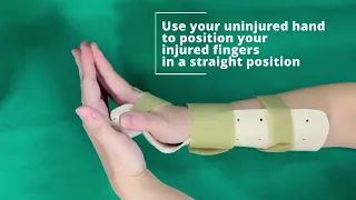 Exercises to Improve Hand Mobility — Extensor Tendon Injury | SKH Occupational Therapy