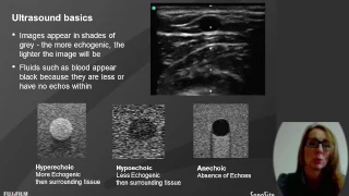 Webinar: Ultrasound in Hemodialysis: Assessment & US-Guided Cannulation for Dialysis Nurses