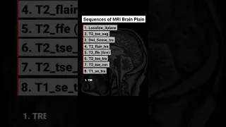 Sequences of MRI Brain #radiology_buzz #radiology_students