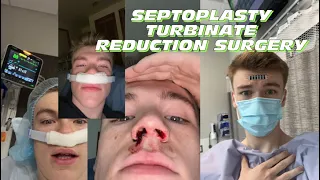 Septoplasty Turbinate Reduction Surgery Recovery vlog + tips! ￼