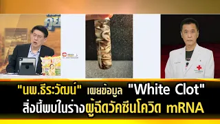 "นพ.ธีระวัฒน์" เผยข้อมูล "White Clot" สิ่งนี้พบในร่างผู้ฉีดวัคซีน mRNA