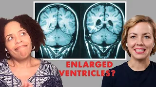 Can Brain Scans and Imaging Help in Diagnosing Schizophrenia? | with Dr. Tracey Marks