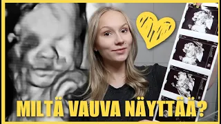 ULTRASSA vauvaa katsomassa👶 | mai day