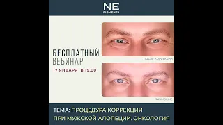 Коррекция татуажа у мужчин. Аллопеция. Рак