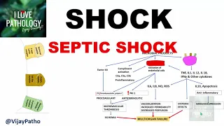 SHOCK: Types, Pathogenesis of Septic Shock