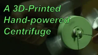 3D-Fuge: a 3D-Printed Hand-Powered Centrifuge