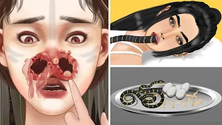 ASMR Satisfying Removal Snake & Maggot From The Mouth | Severely Injured Animation